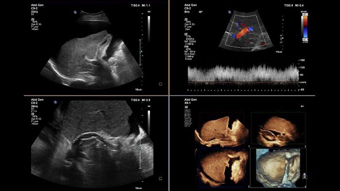ultrasound viewing thumbnail