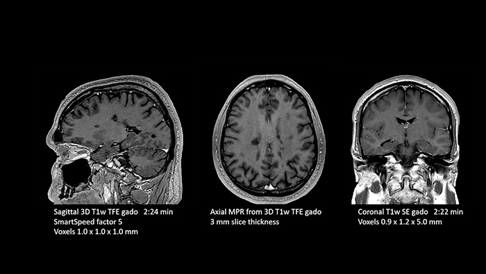 Brain image two