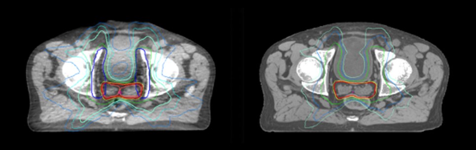 Dataset MRCAT image