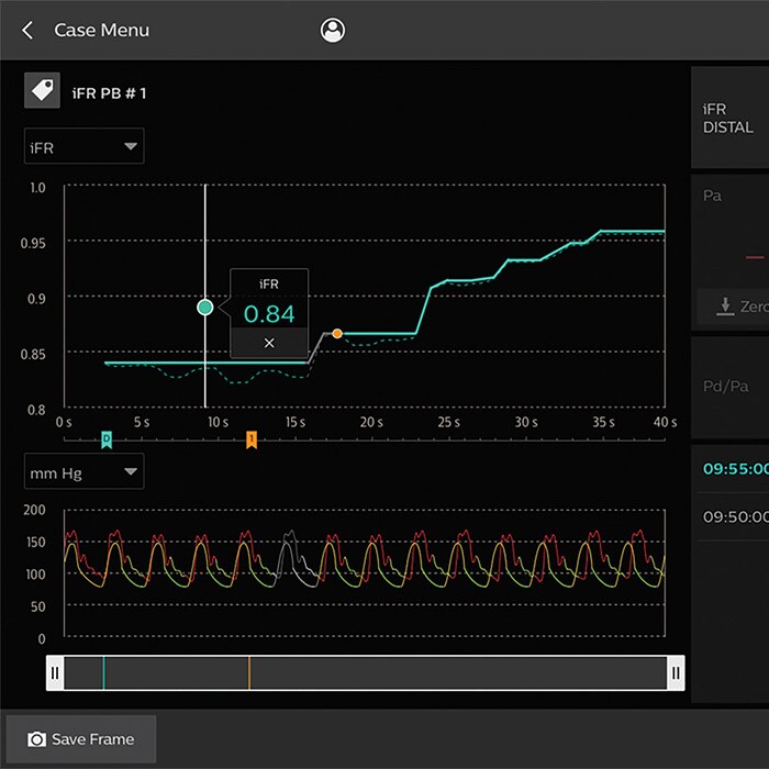 IntraSight iFR Chart software