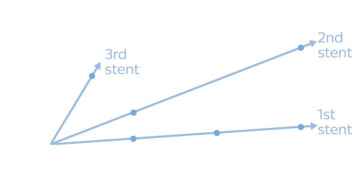 Restenosis graph (Risk of restenosis with each layer of stent)