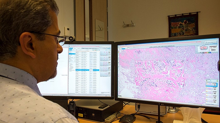 Digital pathology & Computational pathology went from “it will happen" to “it's happening right now” | Philips | Philips