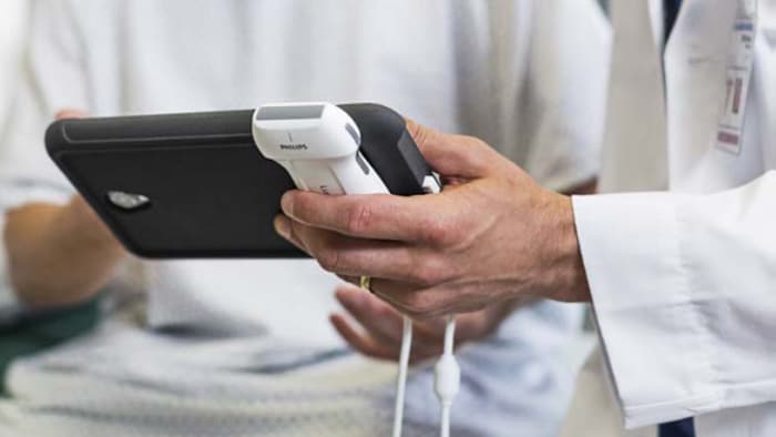 Doctor holding handheld ultrasound