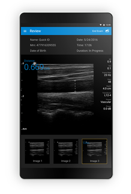 Lumify IOS App | Philips Healthcare