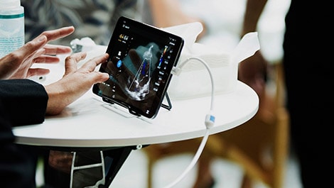 Philips Lumify โซลูชั่นอัลตราซาวน์แบบพกพา